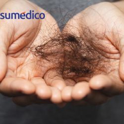 5 alimentos que aceleran la caída del cabello