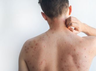 Mundial de futbol, un riesgo por sarampión, alerta especialista 