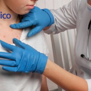 ¿Qué causa la muerte de una persona con sarampión?