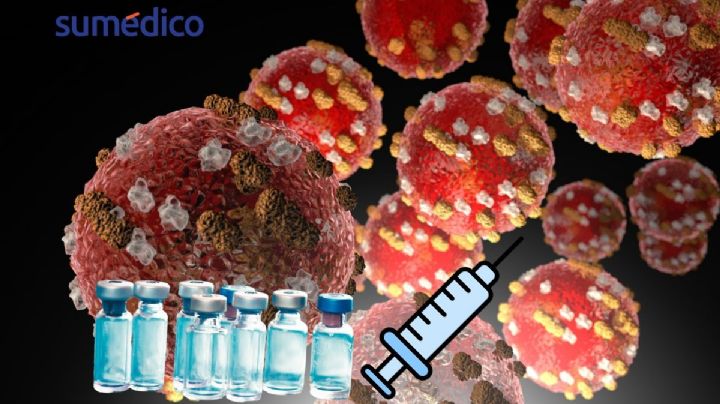 Hay 28 millones de vacunas para enfrentar el brote de sarampión