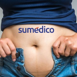 70% de los mexicanos viven con sobrepeso, ¿cuáles son los riesgos para su salud?