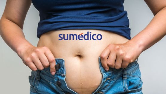 70% de los mexicanos viven con sobrepeso, ¿cuáles son los riesgos para su salud?