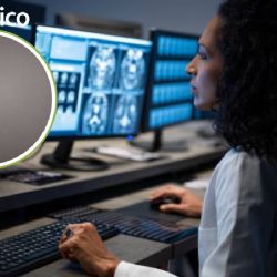 De la contraseña al cerebro: así avanza el Neuro DNI