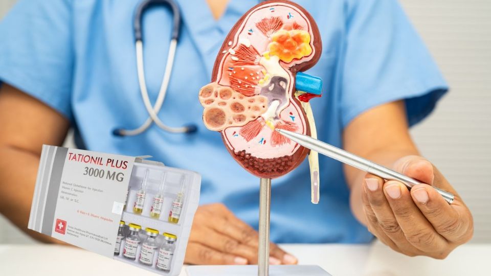 Conoce la función del Tationil Plus, medicamento encontrado en la cabaña del “Mencho'