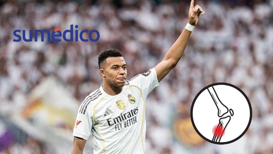 Conoce la lesión por la que Mbappé no juega con el Real Madrid en Champions