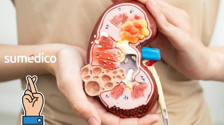 “Cruzo los dedos para que alguien me done un riñón”