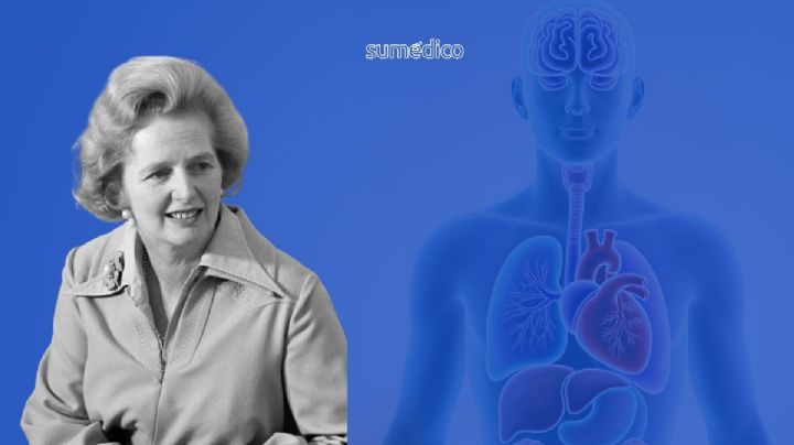 Margaret Thatcher: La salud de la "Dama de Hierro", entre el quirófano y el Síndrome de Hybris