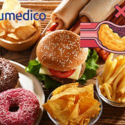 5 alimentos ricos en colesterol que es mejor evitar