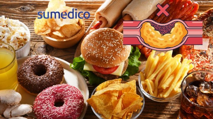 5 alimentos ricos en colesterol que es mejor evitar