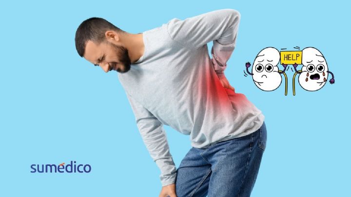 La alerta silenciosa de la enfermedad renal; especialista revela las señales que no debes ignorar