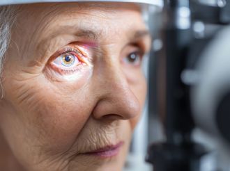 Glaucoma: 870 mil mexicanos en riesgo de ceguera irreversible 