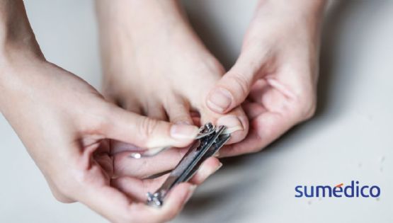 ¿Cómo cortar tus uñas de los pies si tienes hongos?
