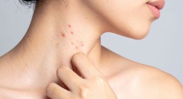 ¿Vacunarte contra el herpes zóster? Este inesperado efecto podría salvar tu corazón