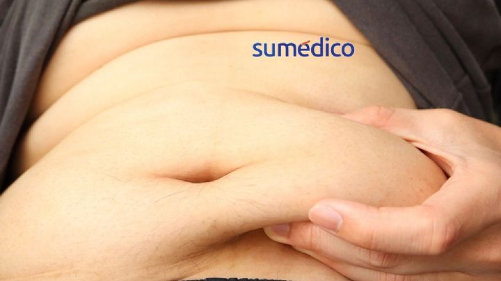 1 de cada 10 muertes por infecciones en el mundo es culpa del sobrepeso: estudio