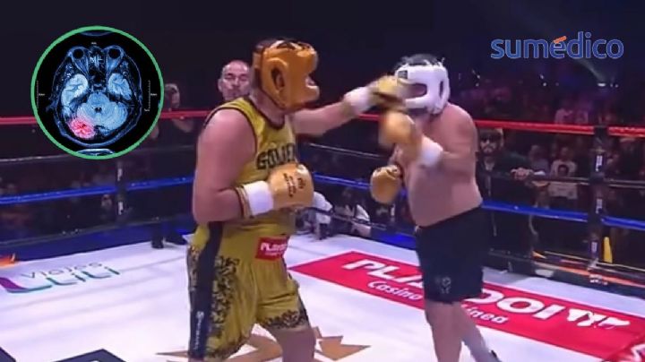 Alfredo Adame y Carlos Trejo: pelear a los 60 eleva riesgo cerebral