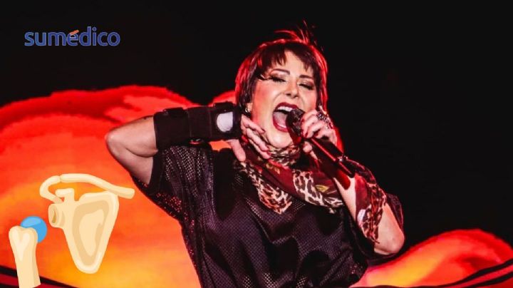 ¿Qué es dislocarse la cadera? Esto le sucedió a Alejandra Guzmán