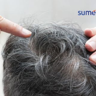 ¿Cuál es la verdadera razón por la que salen canas?
