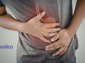 El cáncer colorrectal ha aumentado en jóvenes, ¿a qué se debe?
