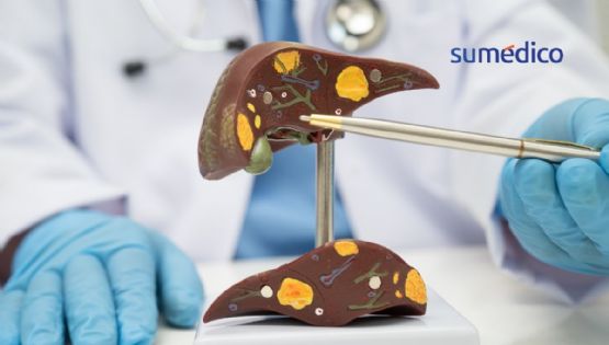 5 claves para mantener el hígado sano