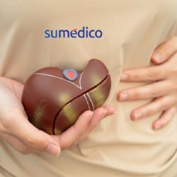 ¿Tienes hígado graso? Esta es la fruta que debes consumir