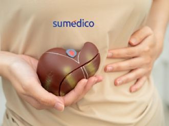 ¿Tienes hígado graso? Esta es la fruta que debes consumir