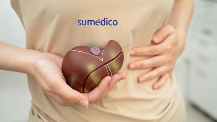 ¿Tienes hígado graso? Esta es la fruta que debes consumir