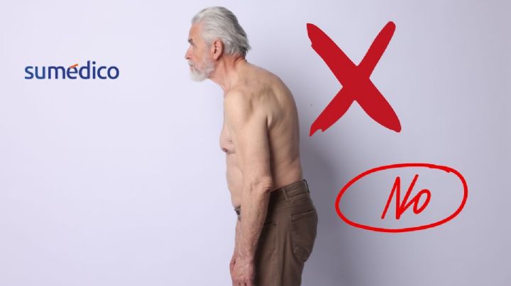 ¿Cómo prevenir que salga “joroba” con el paso de los años?