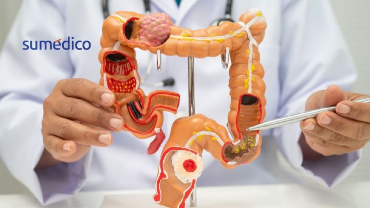 ¿Cómo limpiar el colon de forma eficaz?