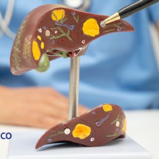 ¿Sabías que el hígado se puede regenerar? Estos alimentos lo ayudan