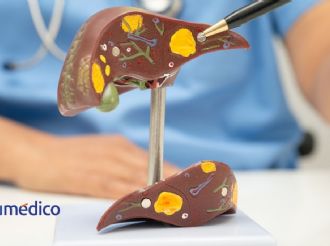 ¿Sabías que el hígado se puede regenerar? Estos alimentos lo ayudan