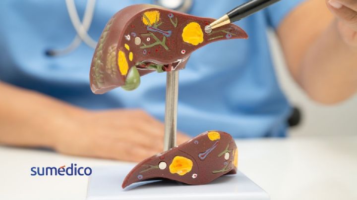 ¿Sabías que el hígado se puede regenerar? Estos alimentos lo ayudan