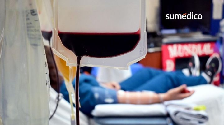 Hemofilia: más común en hombres y sin diagnóstico