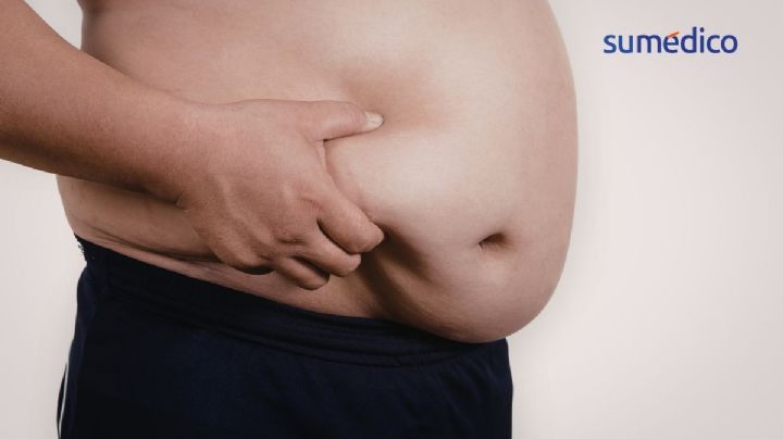 ¿Qué hábitos hacen qué acumules grasa en el abdomen?