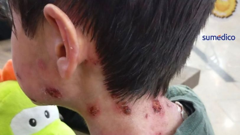 “A ellos les duele la piel, pero a nosotros nos duele el alma”