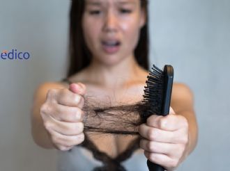 ¿Se te cae mucho el cabello? Estas son algunas prácticas que lo provocan
