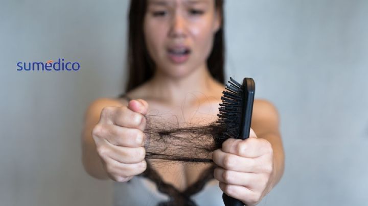 ¿Se te cae mucho el cabello? Estas son algunas prácticas que lo provocan