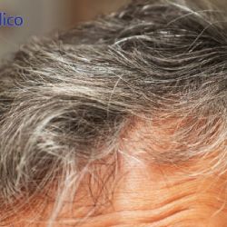 ¿Las canas prematuras te protegen del cáncer?