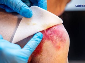 Enfermedades raras: “puede ser mala suerte”