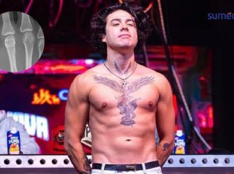 Mario Bautista se rompe el nudillo: esto le espera