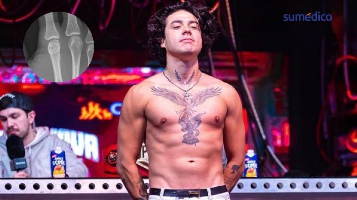 Mario Bautista tiene un nudillo roto: qué implica la lesión