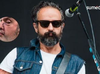 ¿Qué le pasó a Tito Fuentes de Molotov?