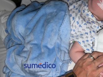 Nico espera cura: el único bebé en México con una mutación ultrarrara