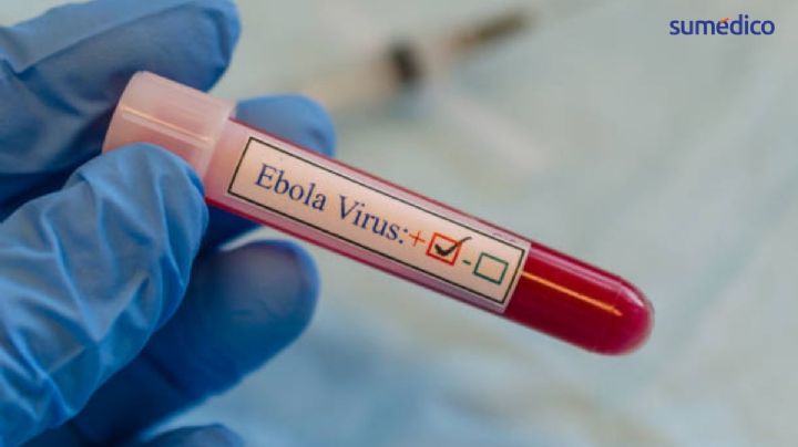 OMS declara emergencia; Secretaría de Salud emite alerta por ébola previo al Mundial