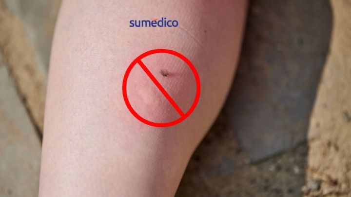 ¿Cómo protegerte de la picadura de mosquitos y prevenir enfermedades?