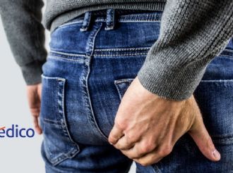 ¿Qué son las hemorroides y cómo prevenirlas?
