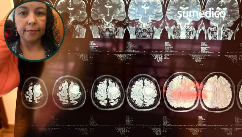 “Pensé que me iba a morir”: la historia de Ana tras un tumor cerebral