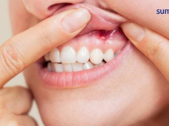El síntoma de menopausia que podría aparecer en tu boca