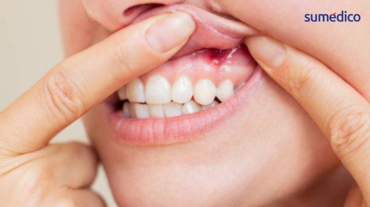 El síntoma de menopausia que podría aparecer en tu boca