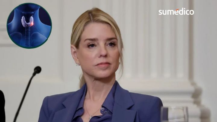 Pam Bondi, ex fiscal de Estados Unidos, enfrenta cáncer de tiroides