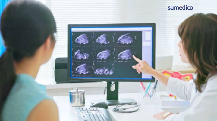 Cáncer de ovario: estar inflamada siempre no es normal